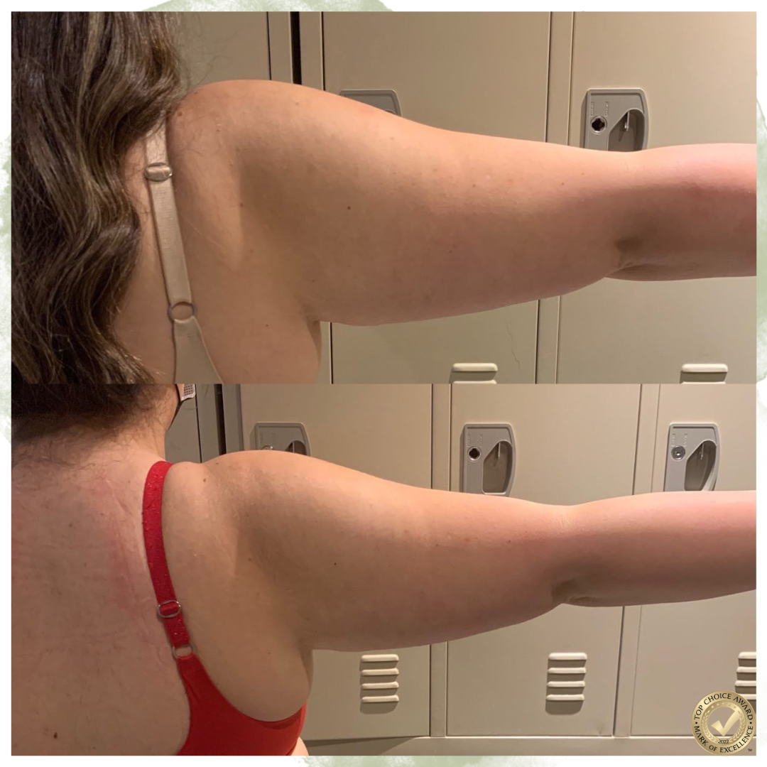 3 Pack- Arm or Leg Sculpt