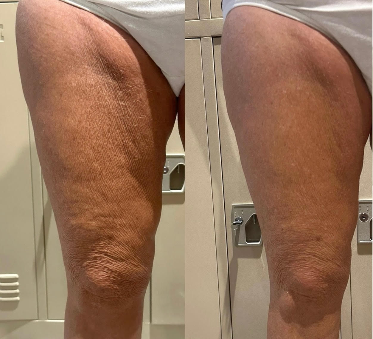 Arm or Leg Sculpt