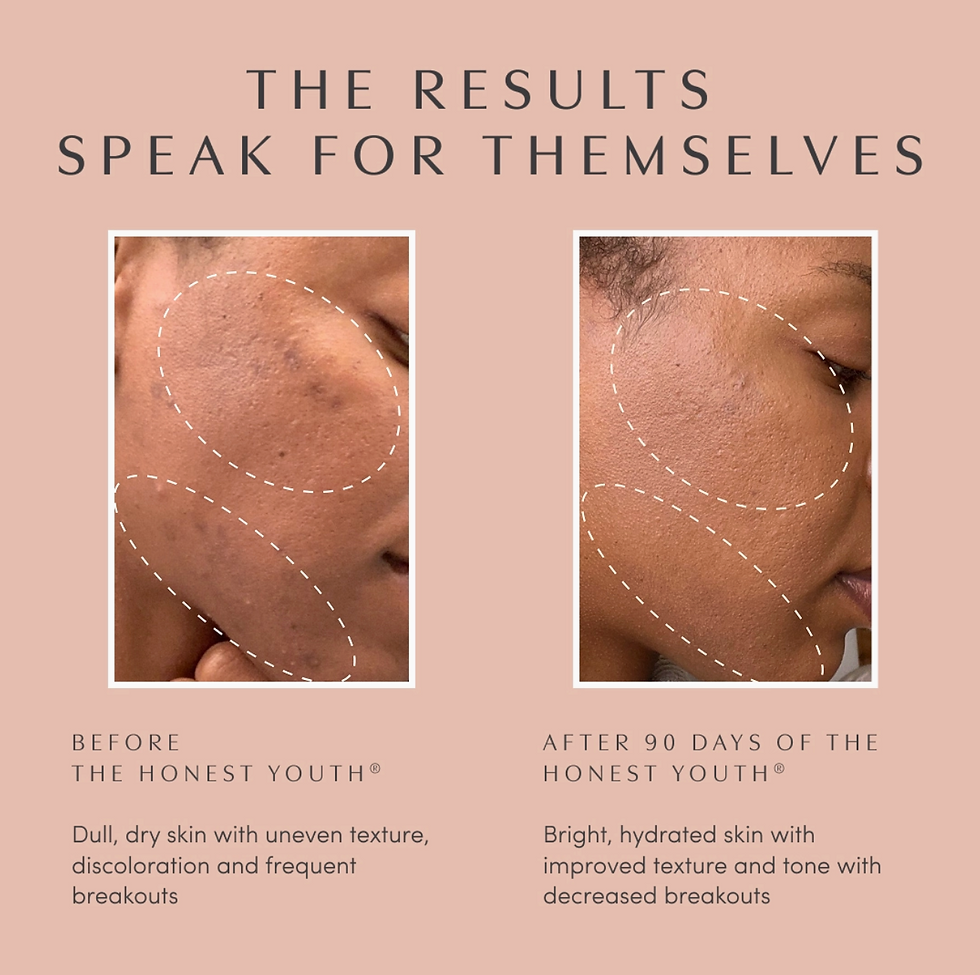 Thumbnail: The Honest Youth™ Skin & Anti-Aging Herbal Drops | Apothékary