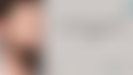 Why Do Men Need Beard Transplants? A List of Reasons You Must Know