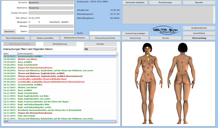 Delta-Scan Analyse