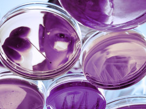 Scientist looking down a petri dishes.