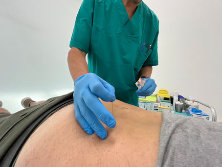 Ossigeno-Ozonoterapia Intradiscale per Ernia del Disco Lombare Sintomatica