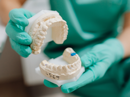 Denti consumati: le abitudini quotidiane che li rovinano senza che tu lo sappia