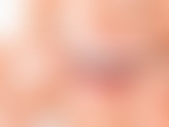 Mascherine trasparenti: davvero possono raddrizzare i denti senza apparecchio?