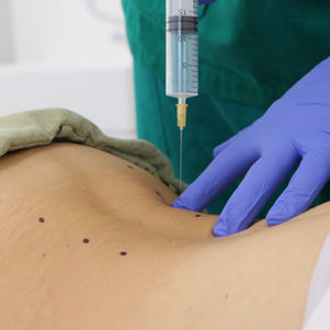 Studio sulla sicurezza dell'applicazione sistemica di ozono e il suo impatto sulla mobilizzazione delle cellule CD34+