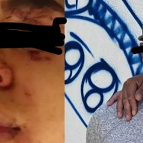 Balean a presunto homicida de Francisco Tenorio, alcalde de Valle de Chalco