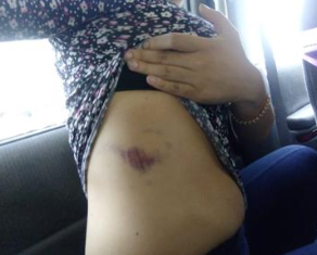 Atacan a familia de Texcoco al interior de su domicilio