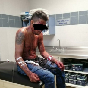 Riña deja un muerto y dos heridos en Chimalhuacán