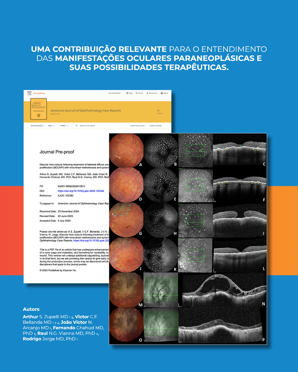 Publicação em revista internacional destaca uso do metotrexato intravítreo em caso raro de BDUMP com buraco macular