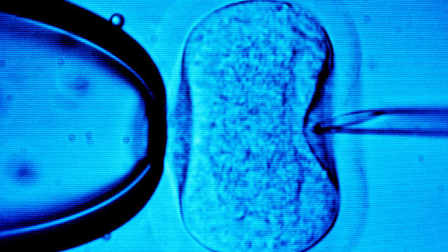 Biologia 12º ano