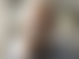 Implante Dentário em Curitiba: Tudo o que Você Precisa Saber