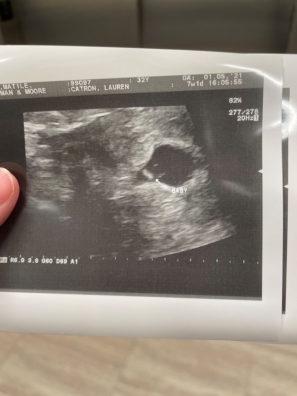 Baby Catron measuring 6 weeks, 4 days