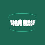 LINEO DIASTEMA