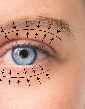 oculoplastics-1024x683.jpg