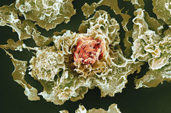 tuberculosis-tb-bacteria-infecting-macrophages-sem-spl-17-1456x967