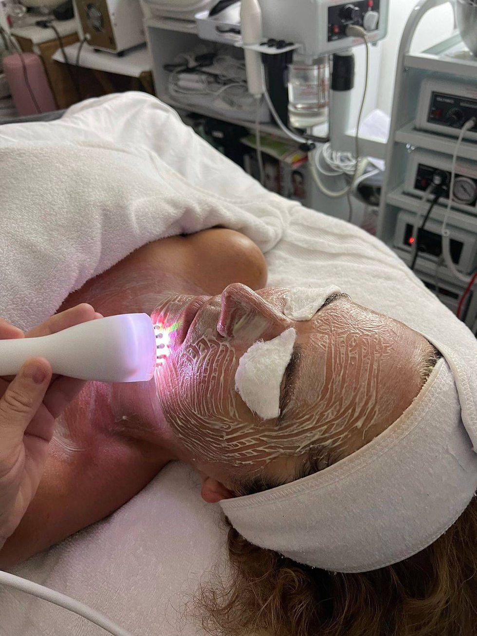 Photodamaged Facial