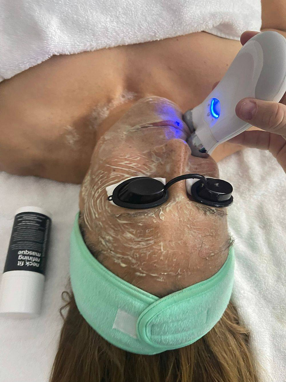 NuFace Microcurrent Treatment