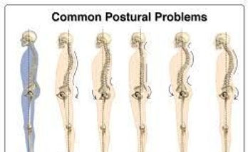 Postural Imbalances