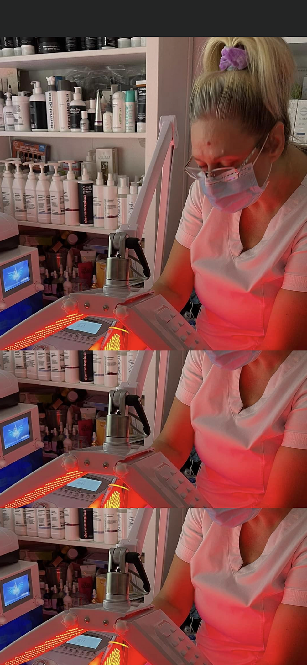 Anti-Aging Jupiter Facial