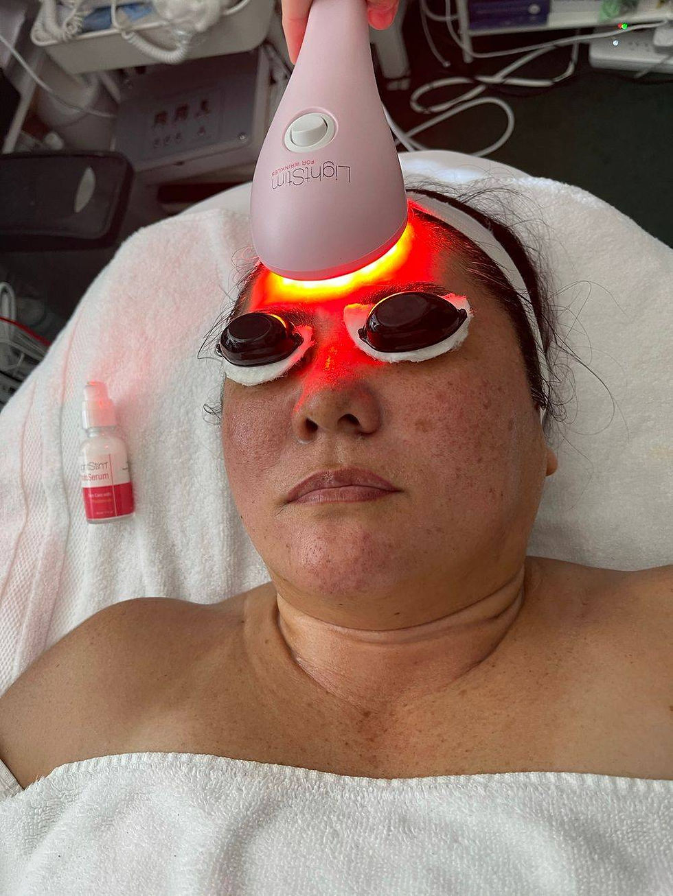 LightStim Wrinkles & Fine Lines Treatment