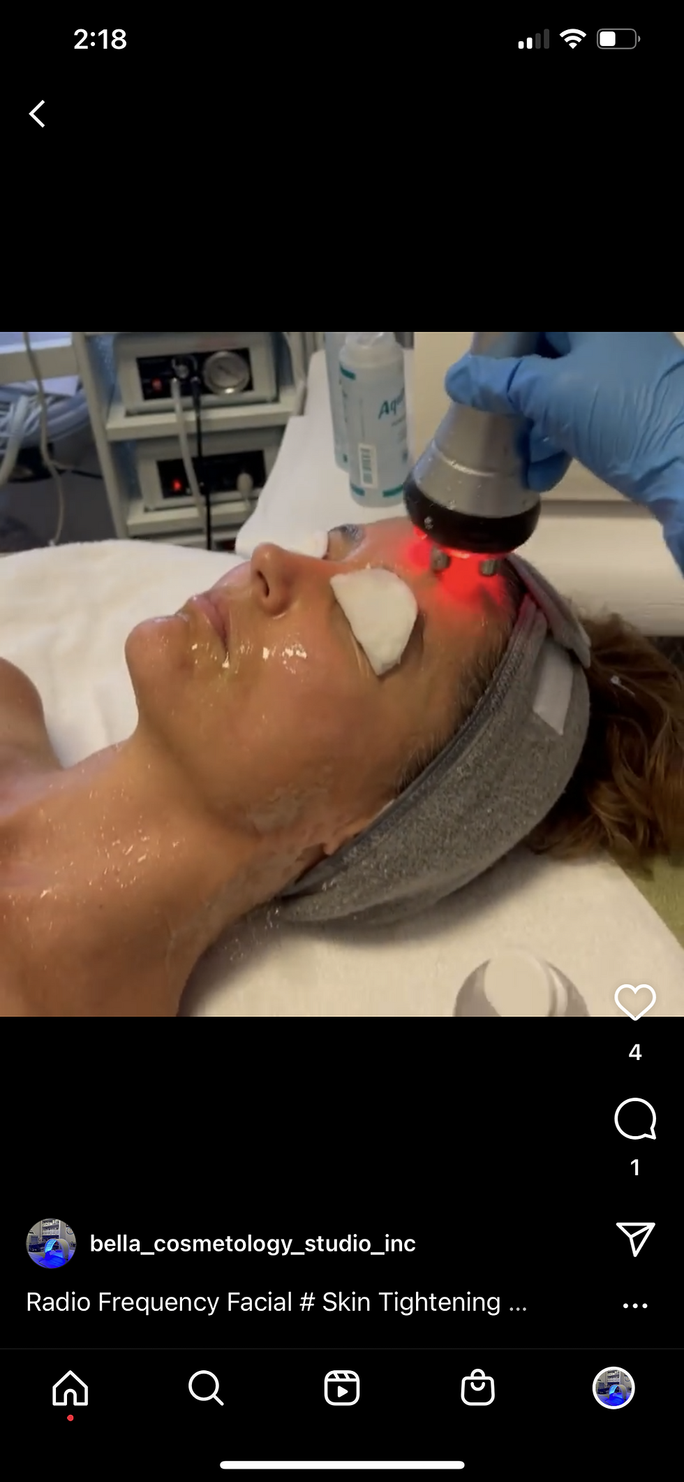 Skin Tightening Radio Frequency Facial
