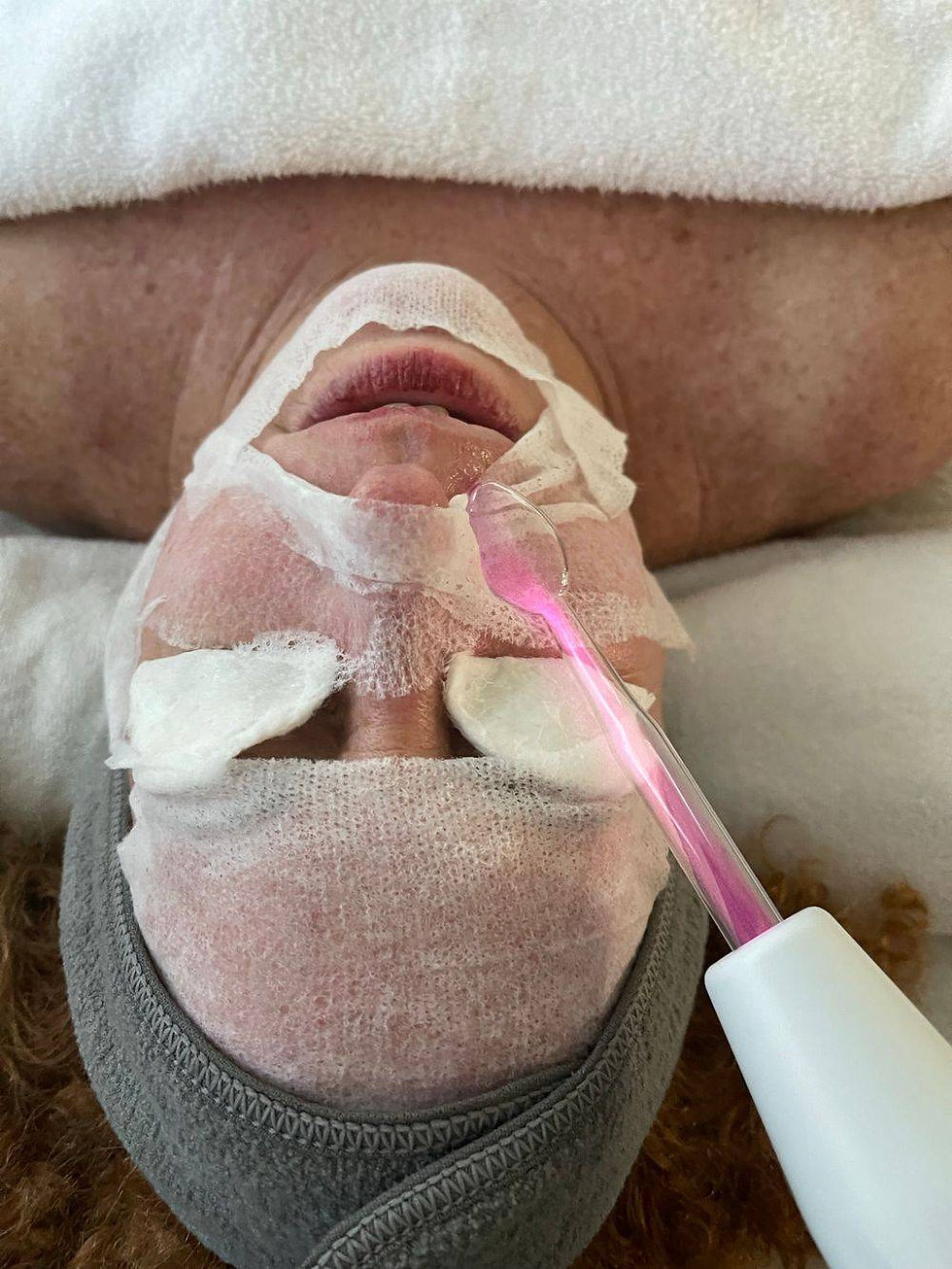 High Frequency & Hyaluronic Acid Mumy Mask