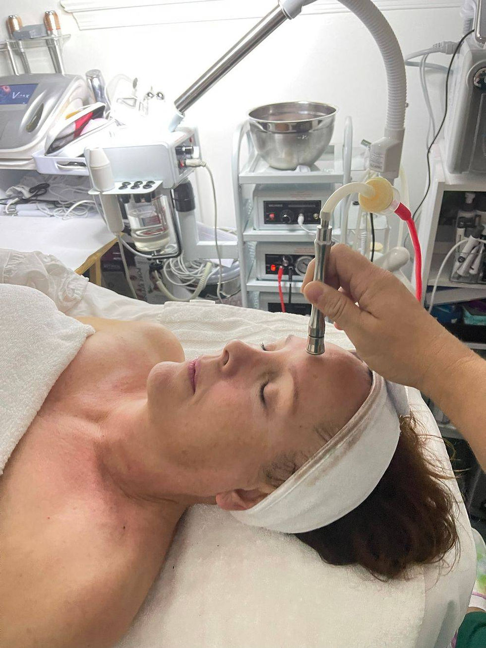 Microdermabrasion Diamond Facial