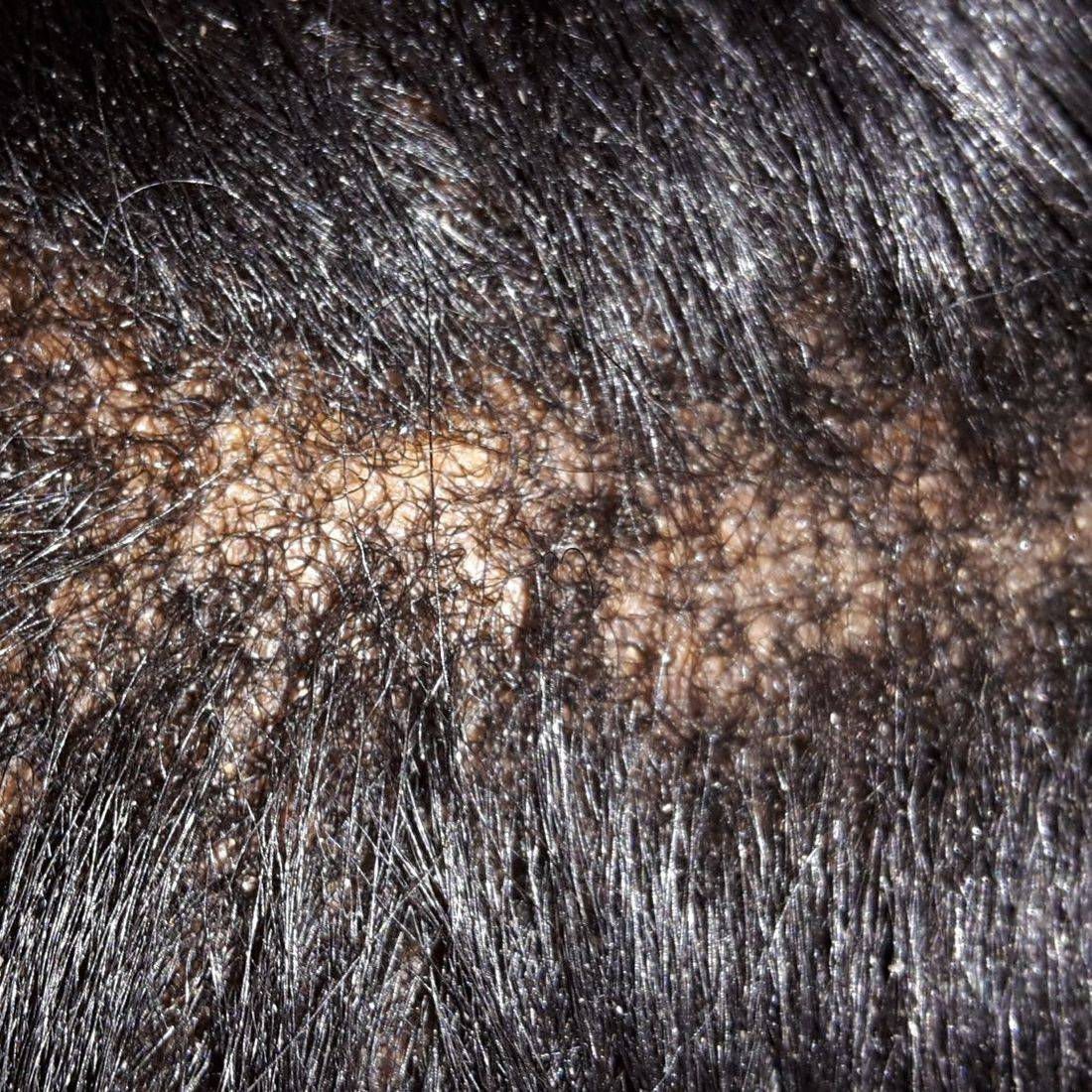 Trichology Hair Loss Prevention Clinic