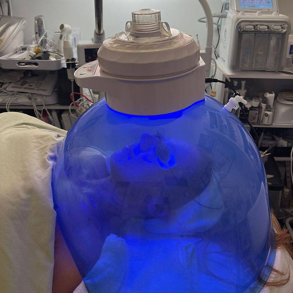 Astro Dome Treatment