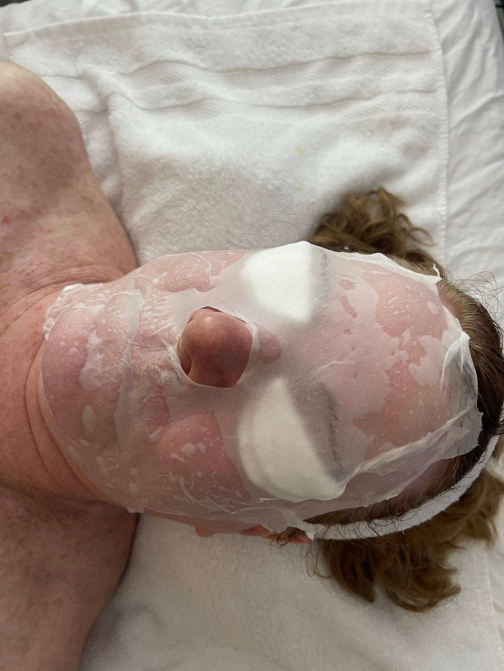 Skin Resurfacing Healing Treatment