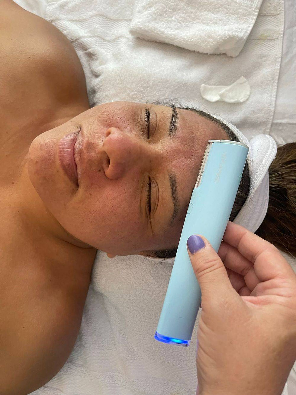Dermaplaning Facial
