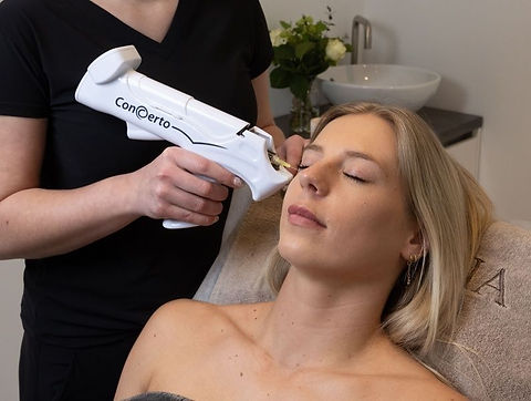 Carboxytherapie behandeling voor de oogregio