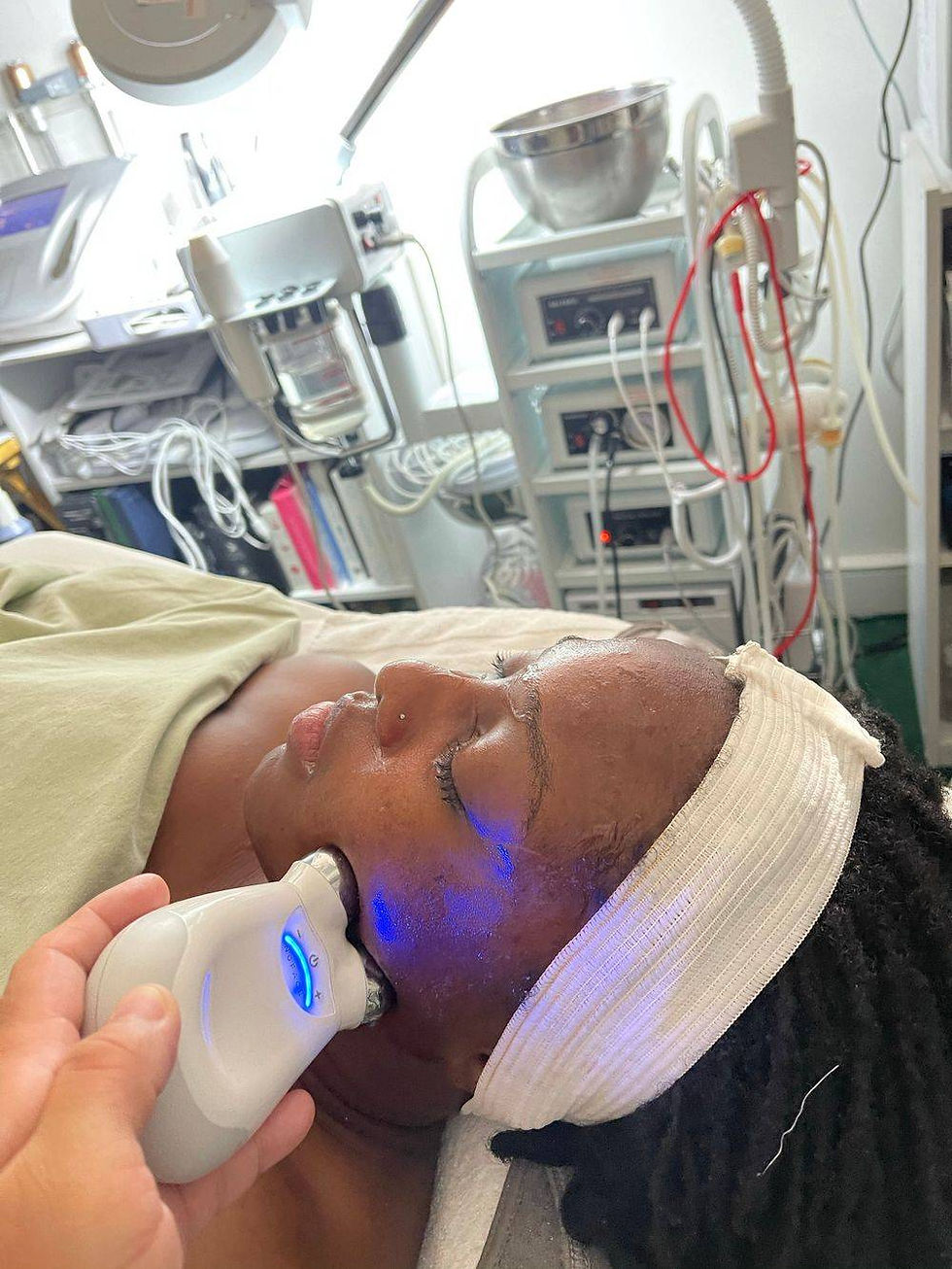 Microcurrent NuFace Treatment