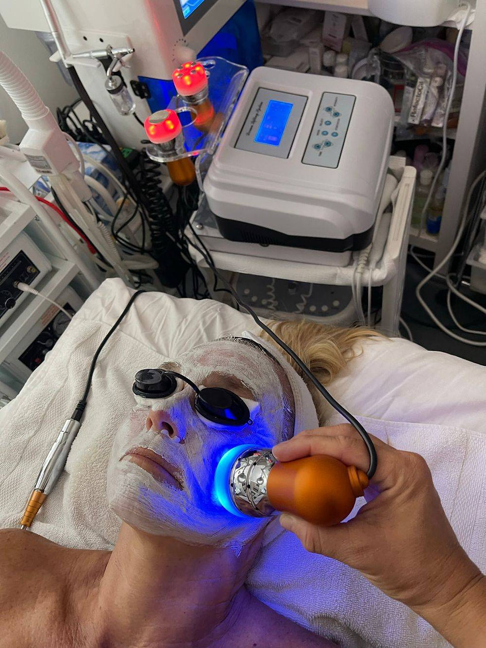 Mesotherapy Facial