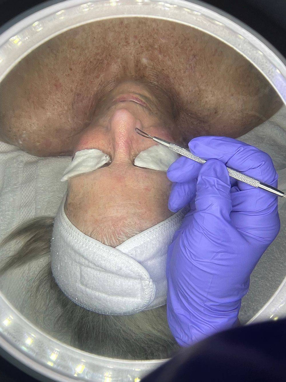 Extraction