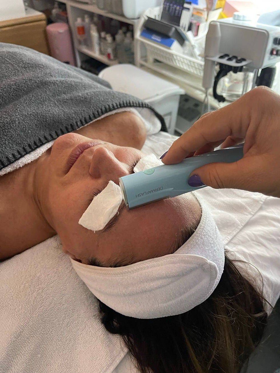 Dermaplaning Facial