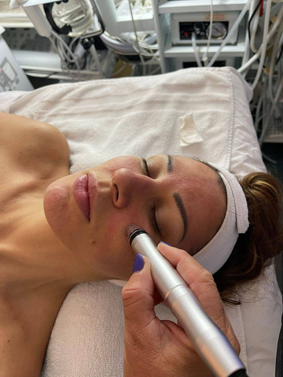 Hydro Facial