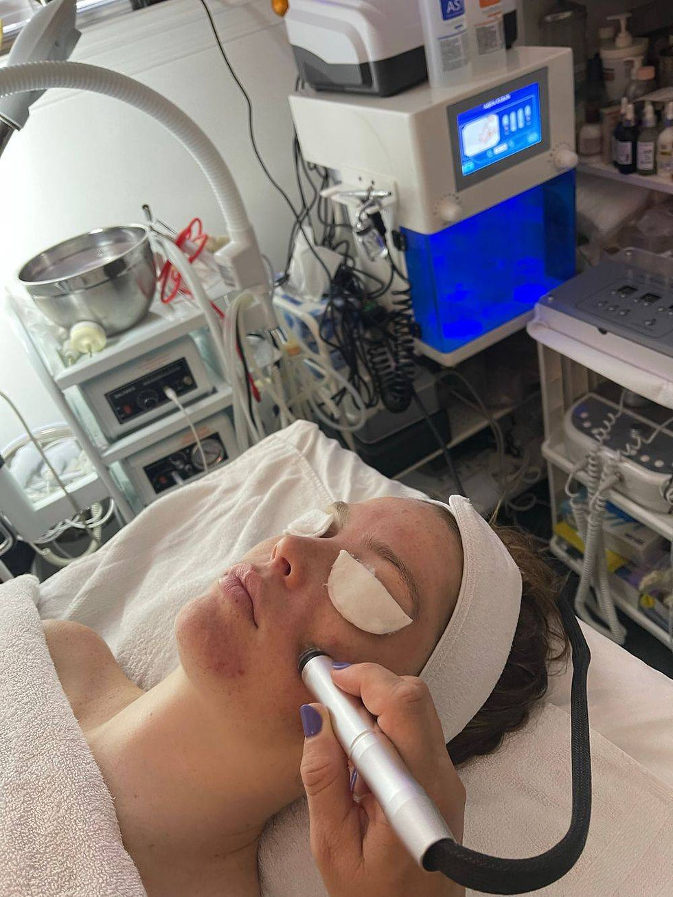 Aqua Peel Treatment - Hydra Facial