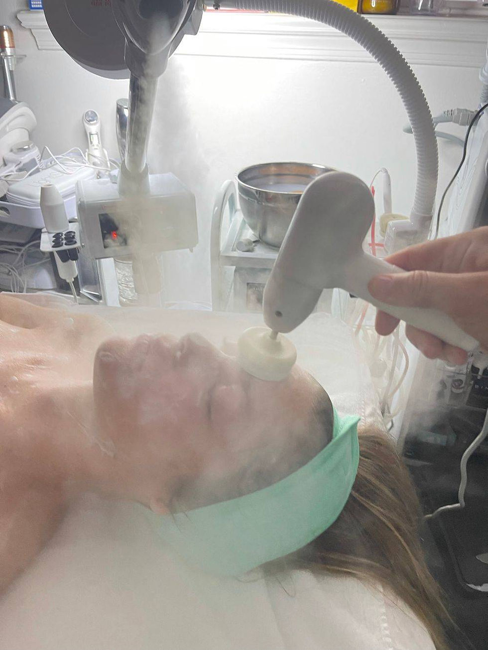 Exfoliation