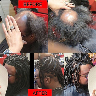 Dreads