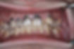 White colored tooth restoration