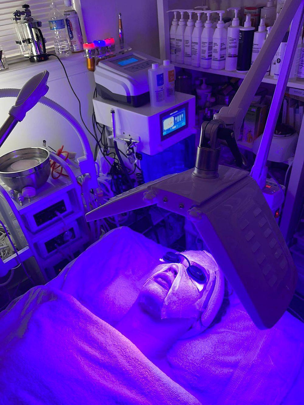 LED Light Acne Treatment