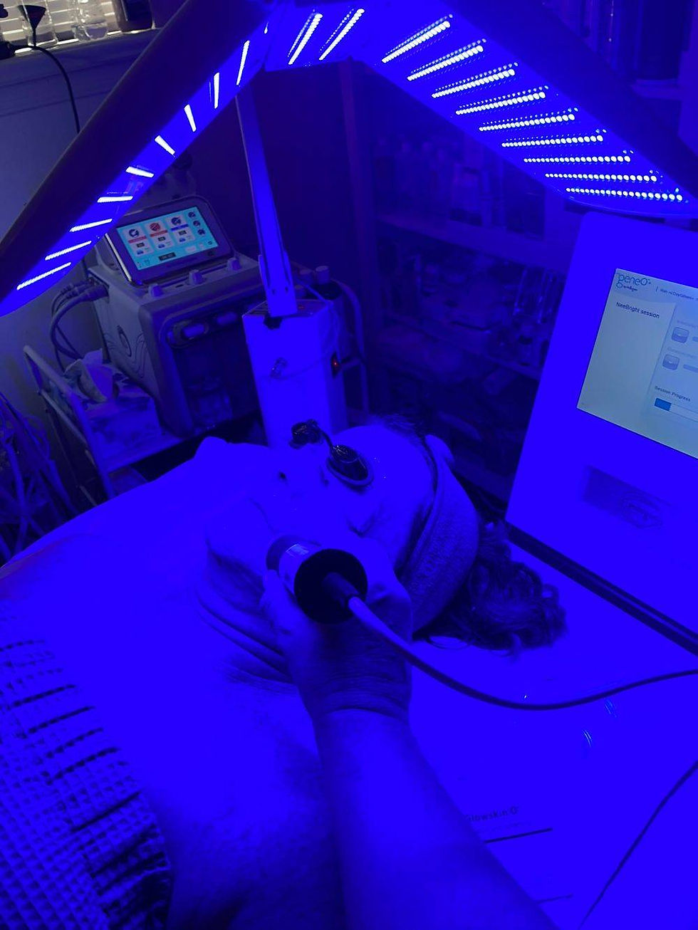 CO2 Oxygenate Facial