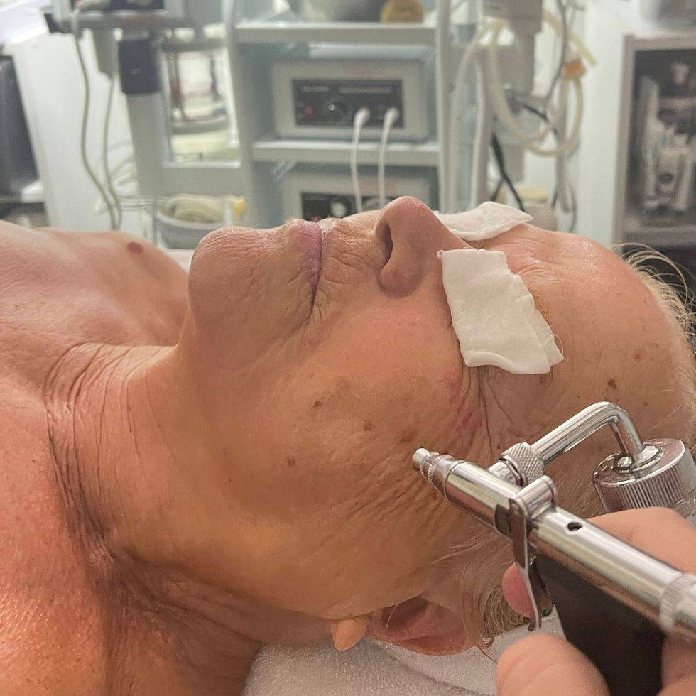 Oxygen Facial