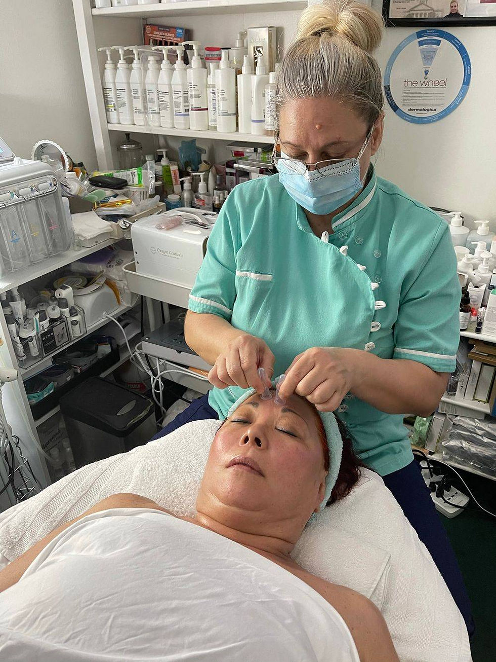 Facial Cupping Massage