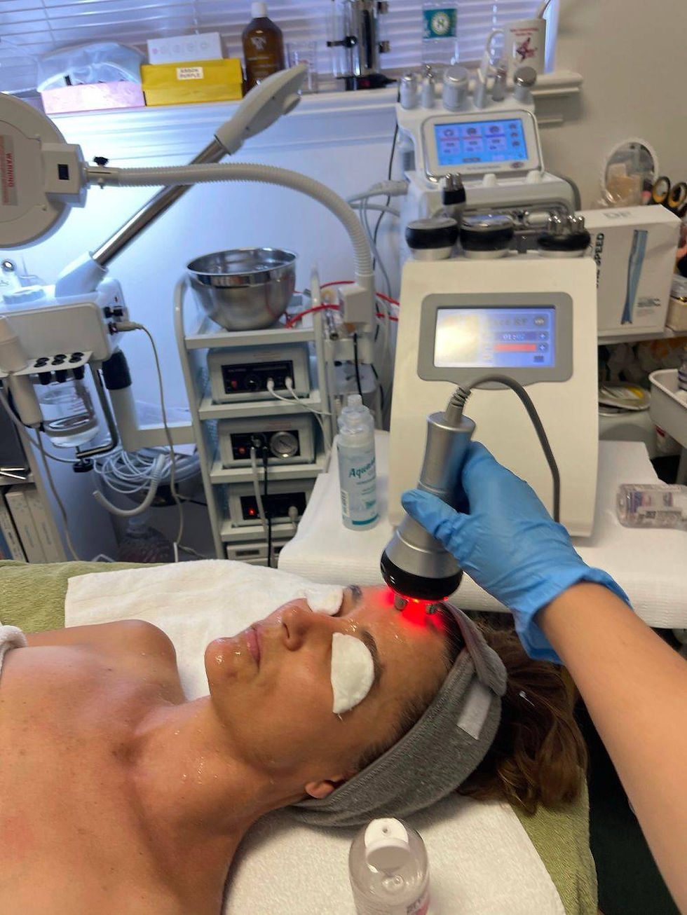 Radio Frequency Skin Tightening Treatment