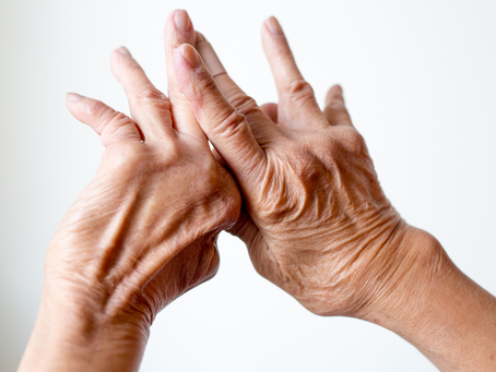 ¿Existen nuevos tratamientos para la Artritis?