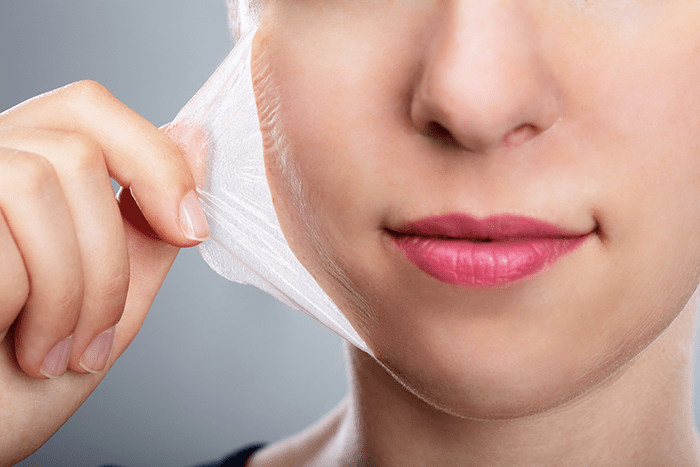 1.-What-to-Expect-With-a-Chemical-Peel