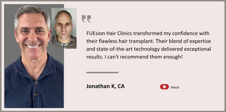 Hair Transplant Beverly Hills - Male Hair Transplant Testimonial